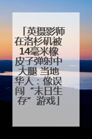 英摄影师在洛杉矶被14毫米橡皮子弹射中大腿 当地华人：像误闯“末日生存”游戏